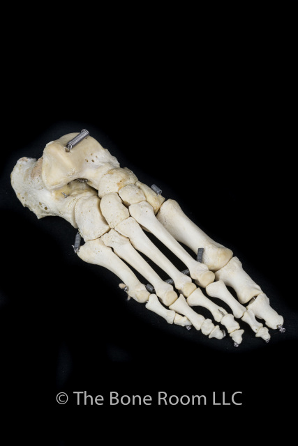 Articulated Human Foot